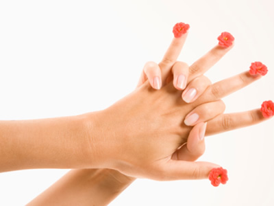 诱发灰指甲的三大原因介绍 诱发灰指甲的三大原因介绍